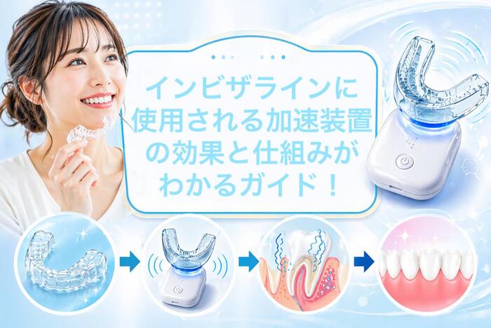 インビザラインに使用される加速装置の効果と仕組みがわかるガイド