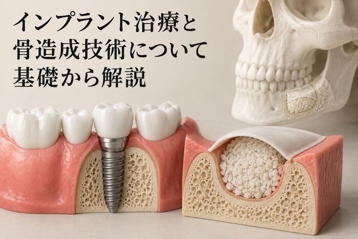 インプラント治療と骨造成技術について基礎から解説｜ブログ｜海岸歯科