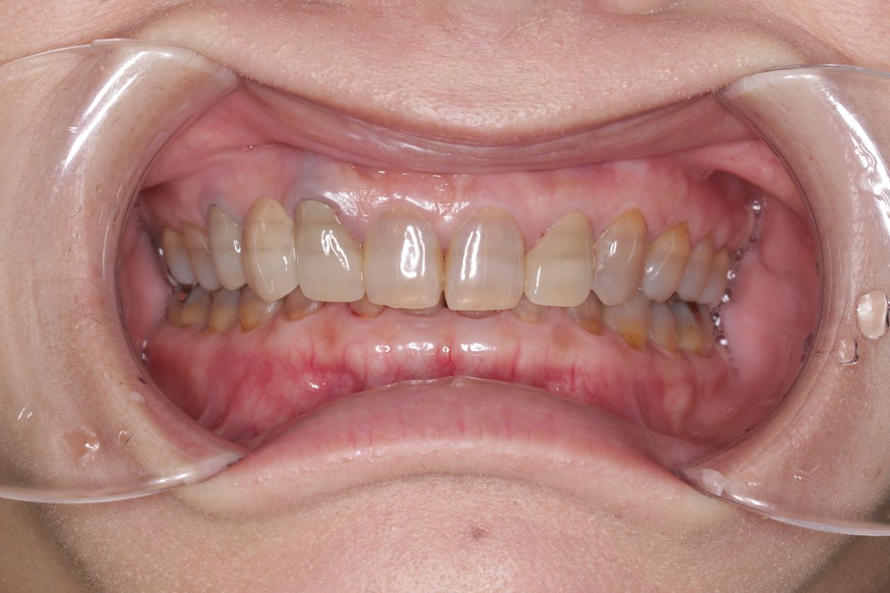 当院の治療例①について