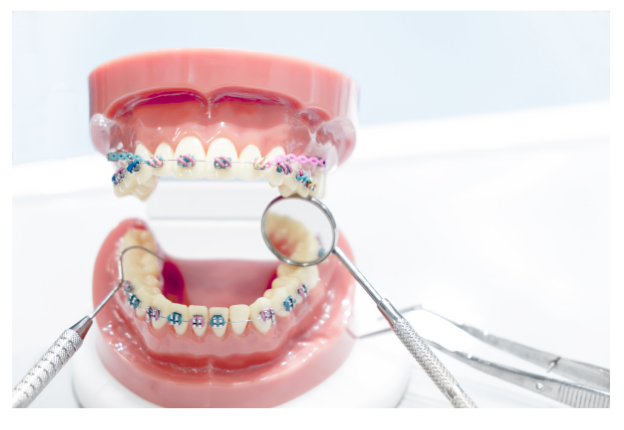 学校歯科検診で「歯並びが悪い」と言われたら?