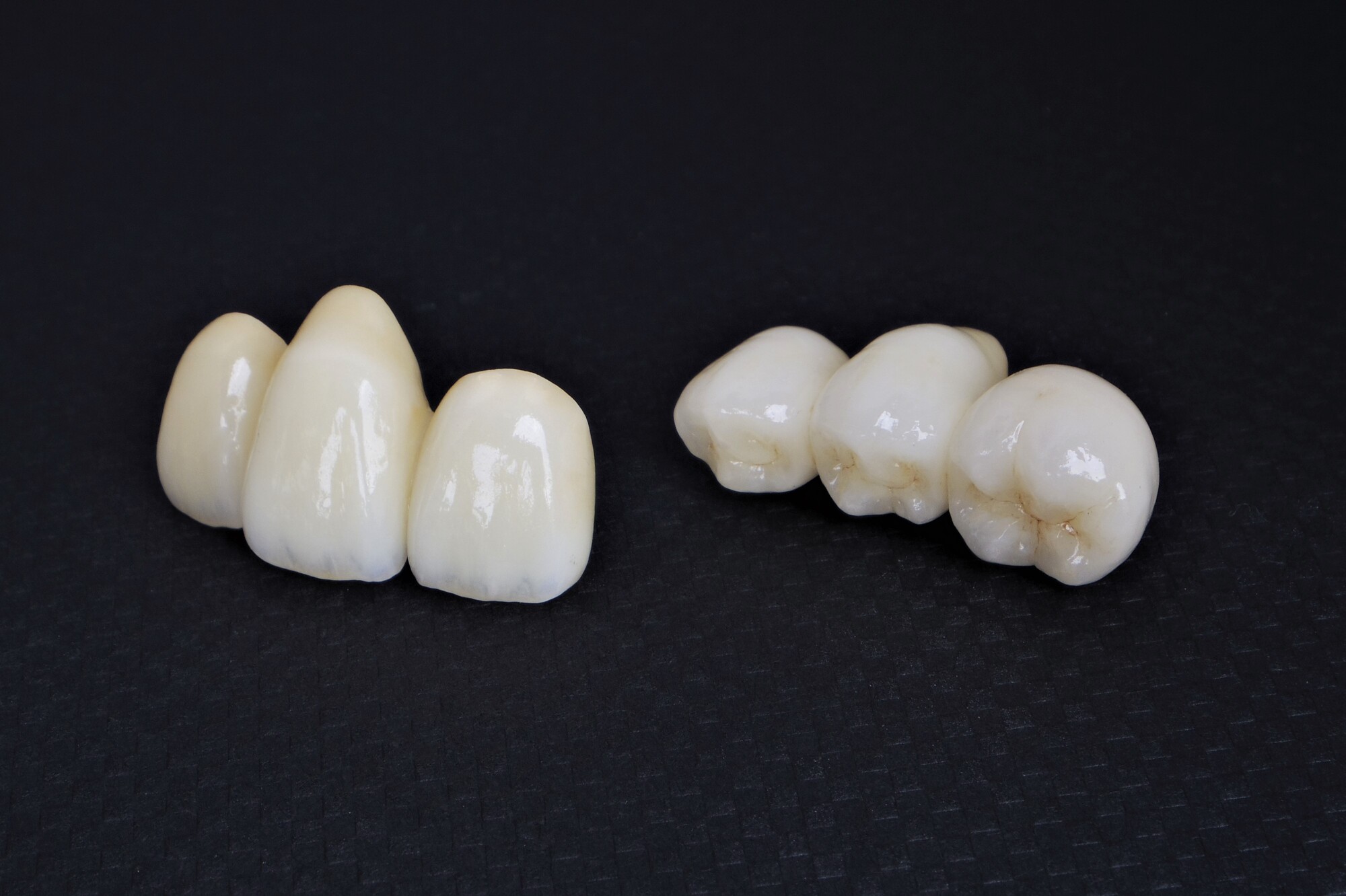 セラミックの種類