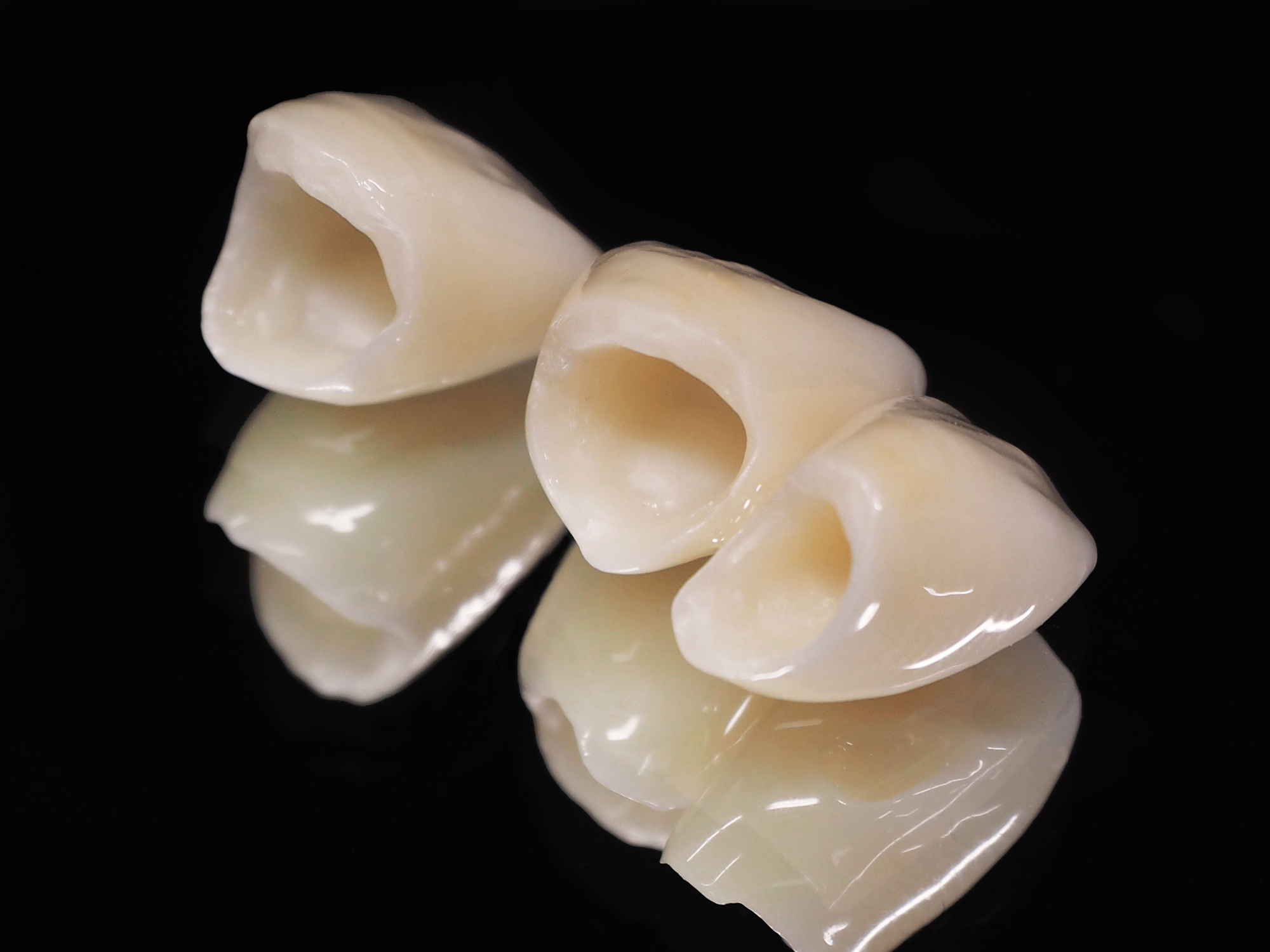 セラミック治療とは？