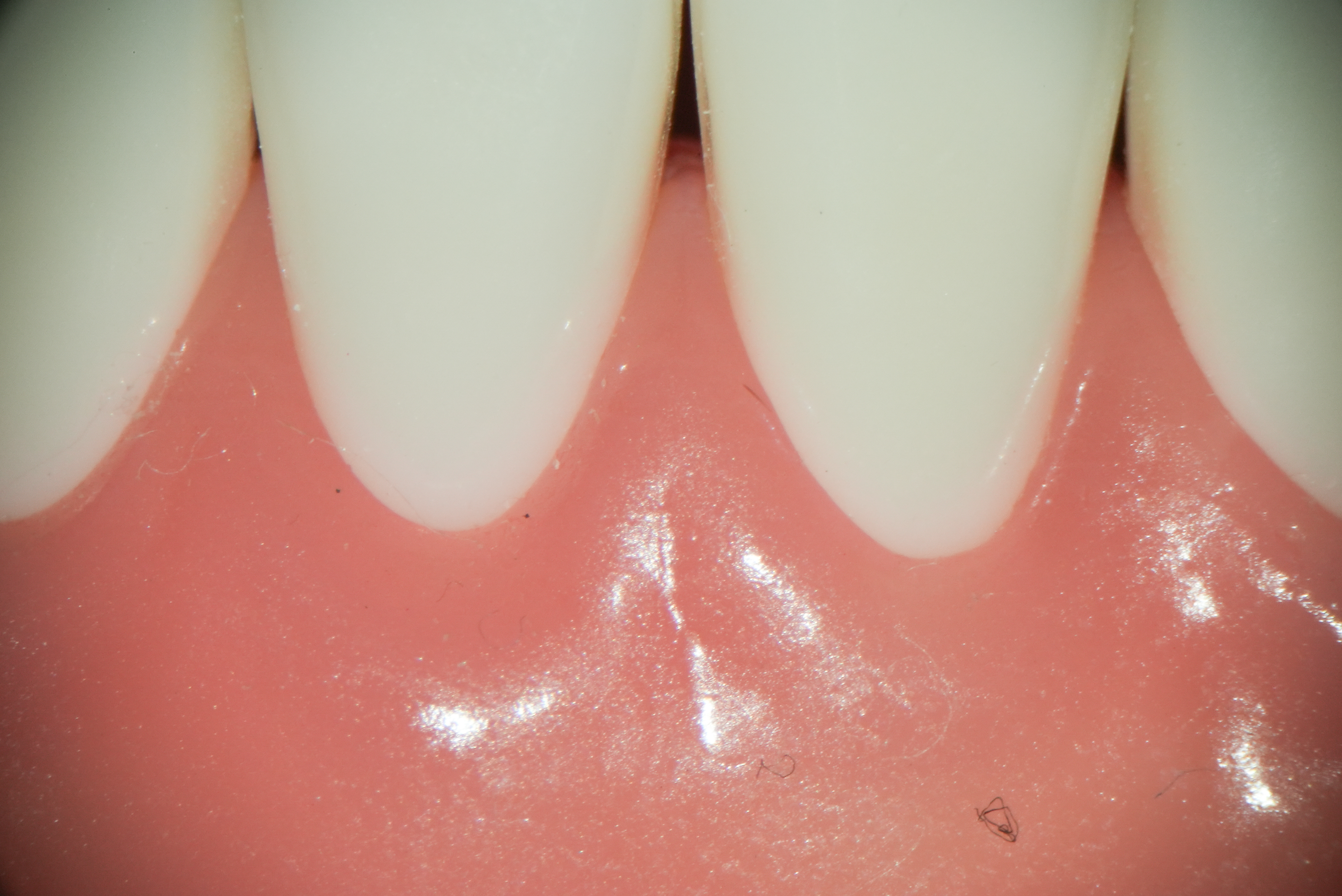 【マイクロスコープで何が見えるの？】精密な治療の秘密を解説！