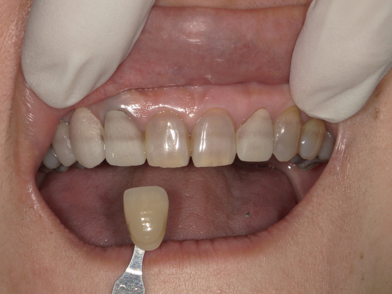 当院の治療例①について