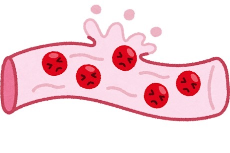 症状が当てはまったらすぐ医療機関へ！〜糖尿病の診断〜