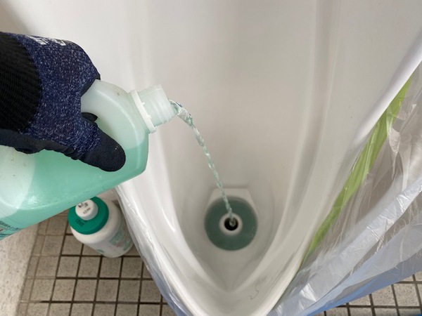 尿石取り